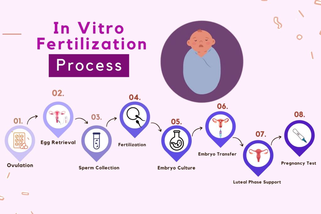 IVF-process, What is In-Vitro Fertilization (IVF) 2024